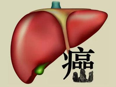 没有一点点防备，肝癌晚期就这样来了_香港济民药业