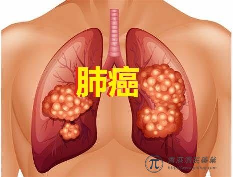 肺癌研究GioTag：阿法替尼（afatinib）+奥希替尼序贯治疗中位总生存期(OS)近4年！_香港济民药业