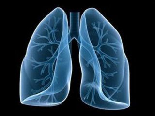 克坐蒂尼治疗ALK阳性的晚期肺癌疗效优于标淮