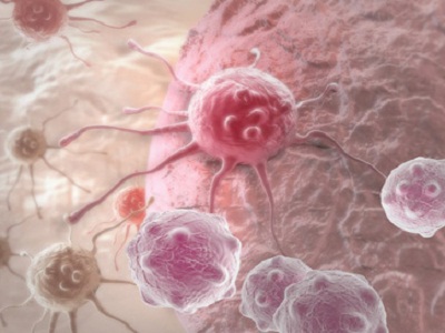欧盟认证：Lynparza一线维持治疗特定类型卵巢癌效果佳！_香港济民药业