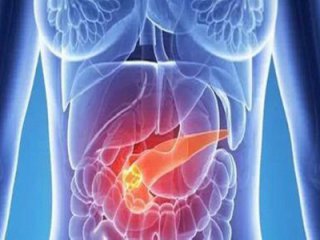 新发现：“ADH-503”化合物或可帮助杀死胰腺肿瘤 