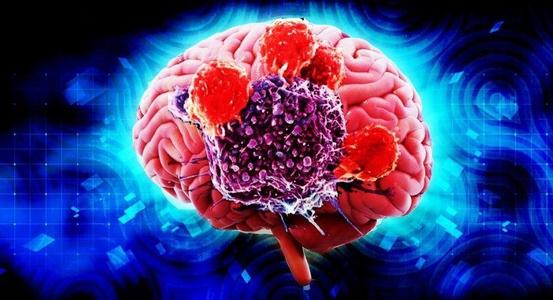 免疫疗法针对特定类型脑癌或有好疗效_香港济民药业