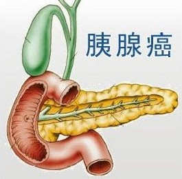 Lynparza(利普卓)获欧盟批准：一线维持治疗gBRCAm胰腺癌_香港济民药业