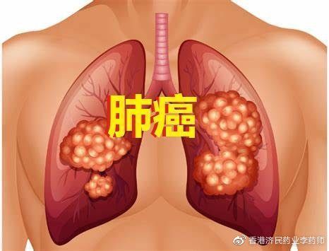 非小细胞肺癌新药MET抑制剂tepotinib在美申请上市获优先审查_香港济民药业