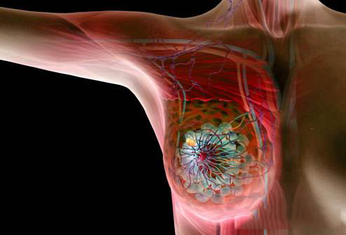 晚期乳腺癌临床试验：玻玛西林/瑞博西尼可改善患者总生存期！_香港济民药业