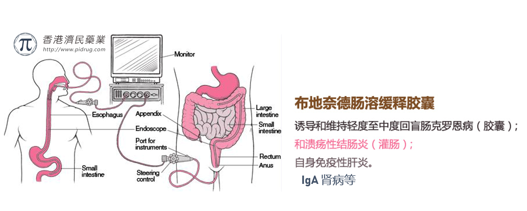 最新研究:布地奈德胶囊(Budesonide)治疗克罗恩、IgA肾病效果怎么样?_香港济民药业