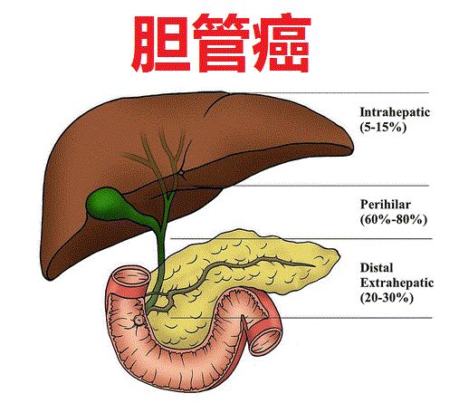 首创IDH1抑制剂Tibsovo治疗IDH1突变胆管癌3期试验结果：显著延长生存期_香港济民药业