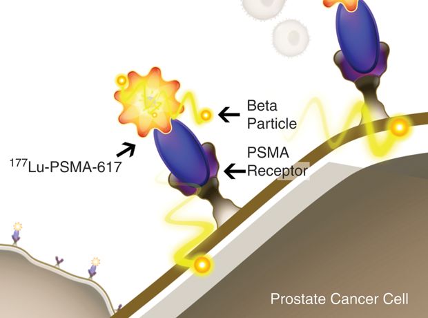 诺华靶向性放射配体疗法177Lu-PSMA-617治疗前列腺癌III期研究成功！_香港济民药业