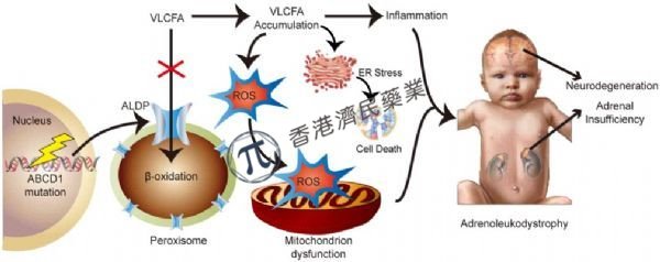 首个治疗脑肾上腺脑白质营养不良(CALD)的基因疗法Skysona即将在欧盟CHMP获批_香港济民药业