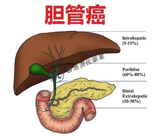 胆管癌靶向新药Truseltiq（infigratinib）获美国FDA加速批准：安全性和耐受性良好_香港济民药业