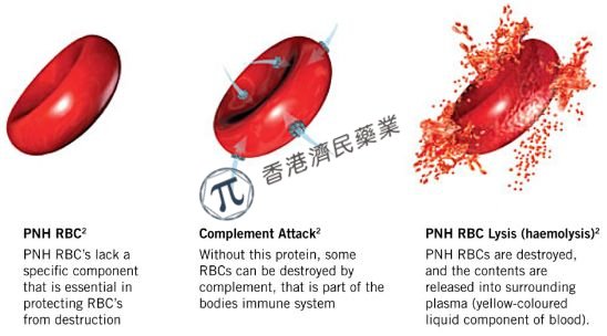 诺华首创口服补体因子B抑制剂iptacopan治疗PNH，疗效显著，耐受性良好！_香港济民药业