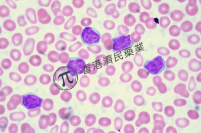 Venclyxto+Gazyvaro固定疗程无化疗方案一线治疗慢性淋巴细胞白血病（CLL） 4年随访结果公布_香港济民药业