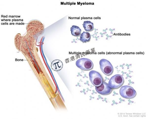 强生Darzalex皮下制剂治疗轻链淀粉样变性和多发性骨髓瘤获欧盟批准，给药仅需3-5分钟！_香港济民药业