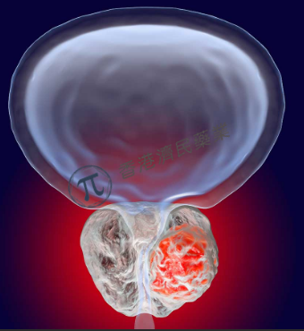 靶向放射配体疗法177Lu-PSMA-617治疗前列腺癌关键3期VISION研究：显著延长总生存期和放射学无进展生存期_香港济民药业