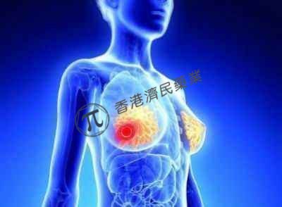 默沙东抗PD-1疗法Keytruda治疗高危早期三阴性乳腺癌 3期临床：显著延长无事件生存期_香港济民药业