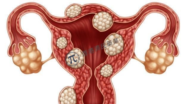 子宫肌瘤第一个长期疗法Ryeqo（relugolix）获欧盟批准：改善月经过多和疼痛