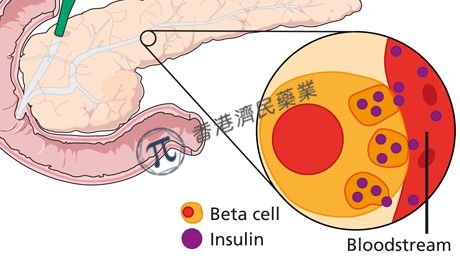 先天性高胰岛素血症新药avexitide获美国FDA授予突破性疗法认定（BTD）