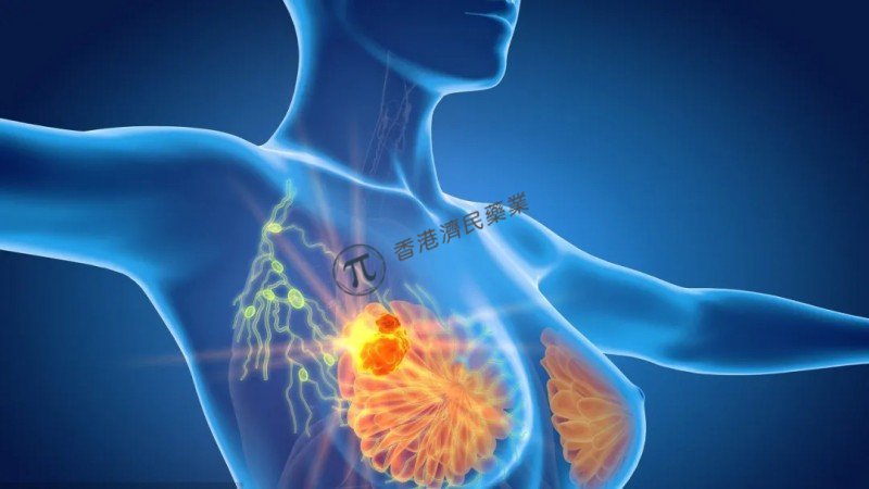 Enhertu治疗乳腺癌头对头III期试验成功，优效性超过Kadcyla！_香港济民药业
