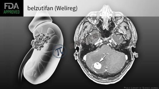 默沙东HIF-2α抑制剂Welireg治疗VHL综合征相关肿瘤获美国FDA批准！