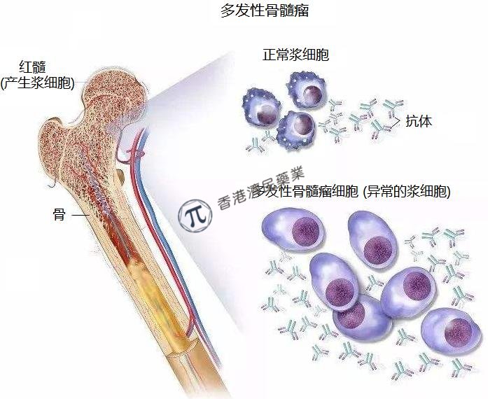 FDA授予CFT 7455治疗多发性骨髓瘤的孤儿药物名称_香港济民药业