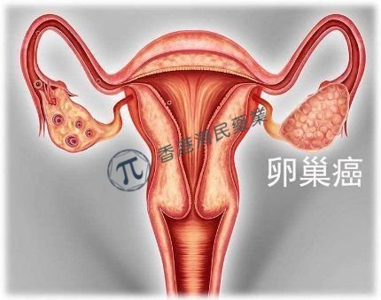 靶向叶酸受体α靶向抗体偶联药物STRO-002α治疗晚期卵巢癌获FDA授予快速通道资格_香港济民药业