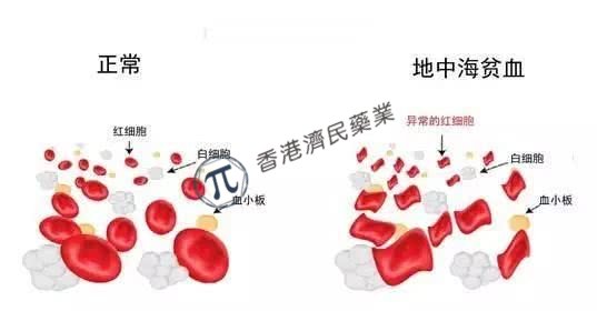 输血依赖性β-地中海贫血基因疗法beti-cel于FDA提交上市申请_香港济民药业