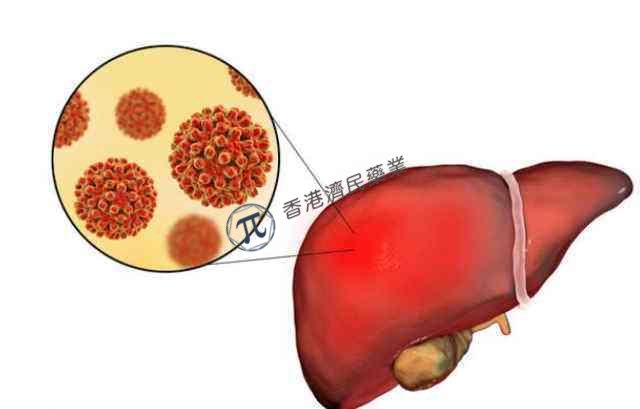 FDA授予efruxifermin快速通道资格，用于治疗非酒精性脂肪性肝炎（NASH）_香港济民药业