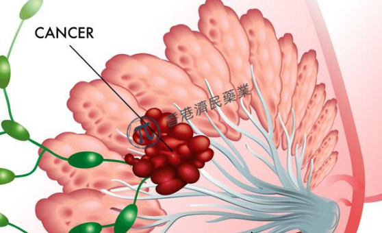 选择性雌激素受体降解剂（SERD）elacestrant用于ER+/HER2-乳腺癌 3期临床获得成功_香港济民药业