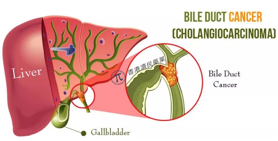 FGFR抑制剂Infigratinib在FGFR2突变胆管癌中显示出有希望的早期活性_香港济民药业