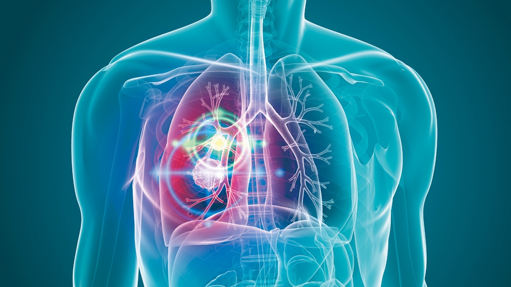 11月17日国际肺癌日，关于肺癌你了解多少，有哪些预防措施？_香港济民药业