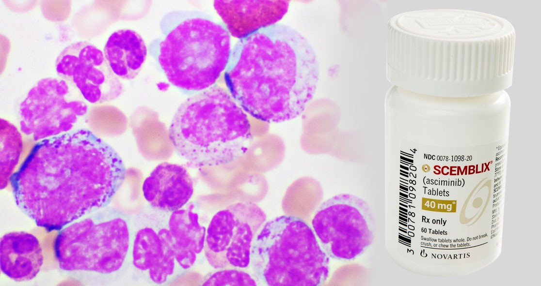 ASH2021年会上公布慢性粒细胞白血病新药Scemblix在48周随访中显示出持续的应答率_香港济民药业