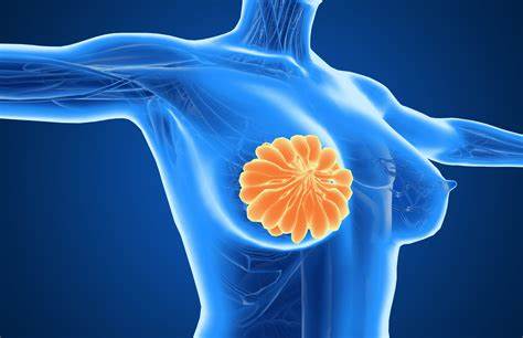 FDA授予Gedatolisib治疗转移性乳腺癌快速通道标识