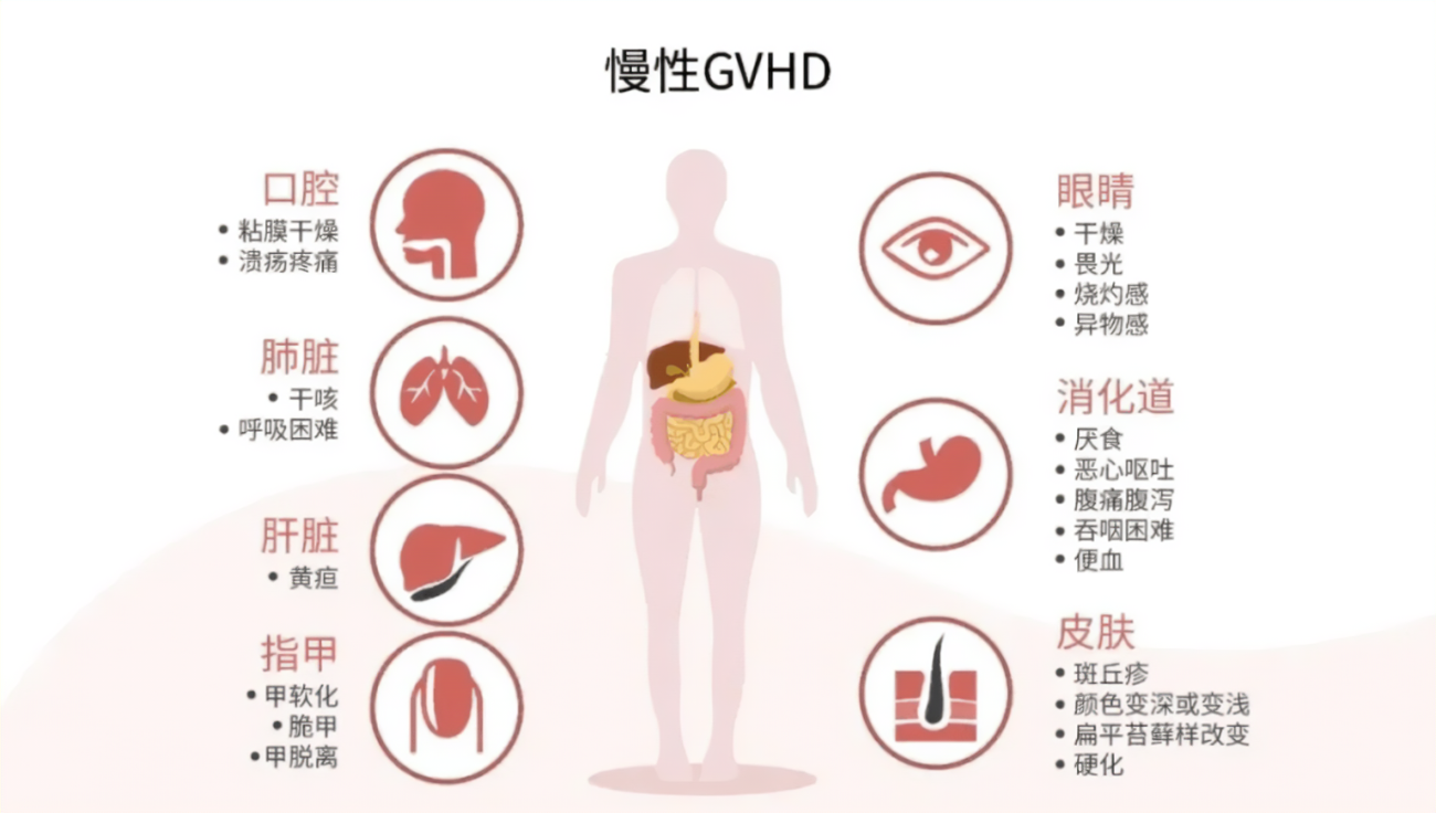 局部ruxolitinib (Opzelura)对皮肤慢性移植物抗宿主病有效且可耐受_香港济民药业