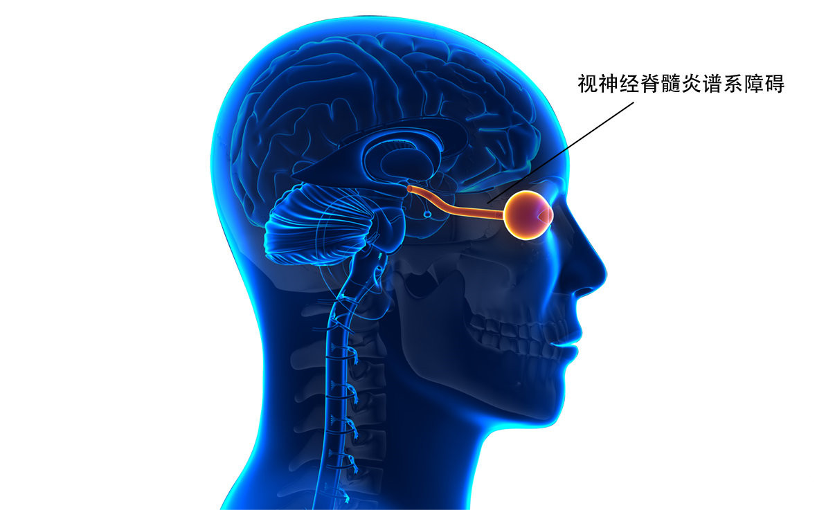 C5补体抑制剂Ultomiris在3期试验中达主要终点,显著减少视神经脊髓炎谱系障碍复发！_香港济民药业
