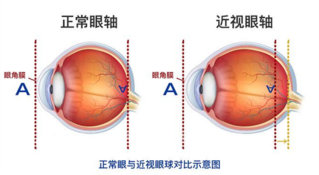 家长必看: 含防腐剂的阿托品滴眼液安全吗？_香港济民药业