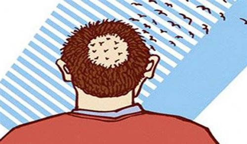 口服JAK抑制剂CTP-543治疗斑秃3期临床试验结果积极，接近一半患者实现80%头皮毛发覆盖率！