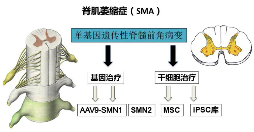 脊髓性肌萎缩症新药Evrysdi(risdiplam)获FDA扩大适应症范围至2个月及以下的婴儿患者_香港济民药业