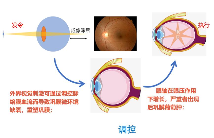  科普|脉络膜和近视的有什么关系，低浓度阿托品能使脉络膜变薄吗？_香港济民药业