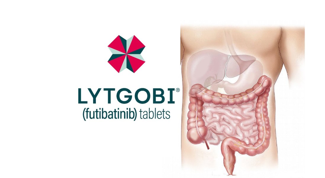 美国FDA批准胆管癌第三个FGFR靶向药Lytgobi(futibatinib)