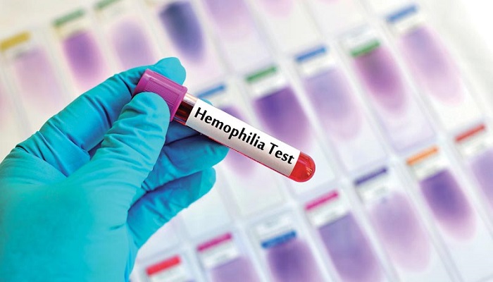 首个B型血友病基因疗法！欧盟授予HEMGENIX有条件上市_香港济民药业