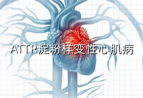 FDA接受首款RNAi在研药物patisiran治疗ATTR淀粉样变性心肌病的补充新药申请_香港济民药业