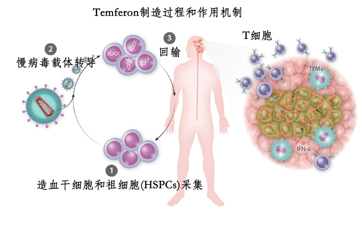 FDA授予Temferon治疗多形性胶质母细胞瘤孤儿药称号_香港济民药业