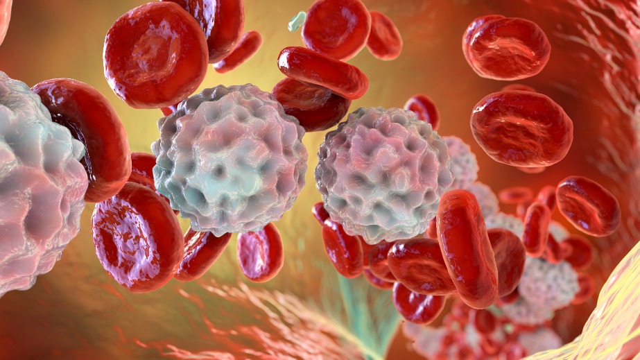 Polivy一线治疗弥漫性大B细胞淋巴瘤获得FDA专家组投票支持_香港济民药业