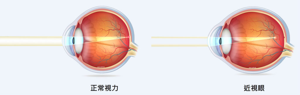 改变不良用眼习惯，配合使用善瞳控制近视效果更佳_香港济民药业