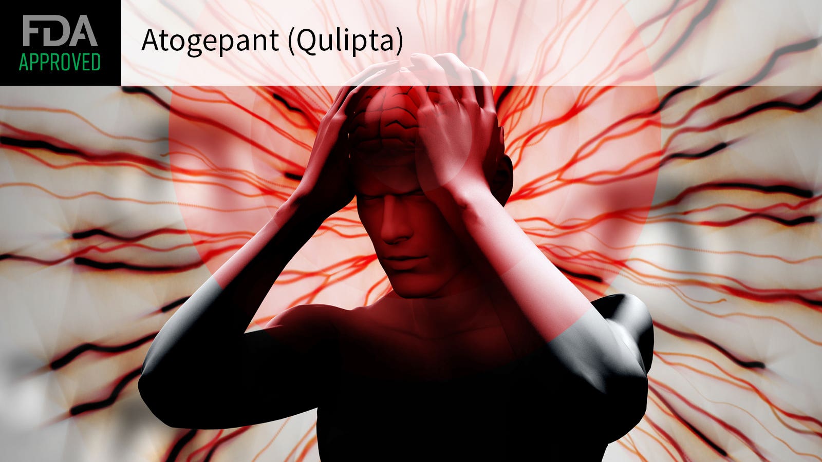 QULIPTA(atogepant)获FDA扩大适应症：用于成人慢性偏头痛的预防性治疗