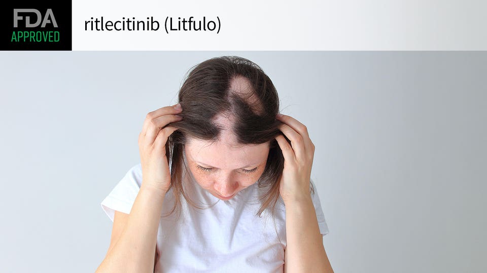 第二款斑秃JAK抑制剂！FDA批准LITFULO(ritlecitinib)治疗12岁以上的青少年斑秃