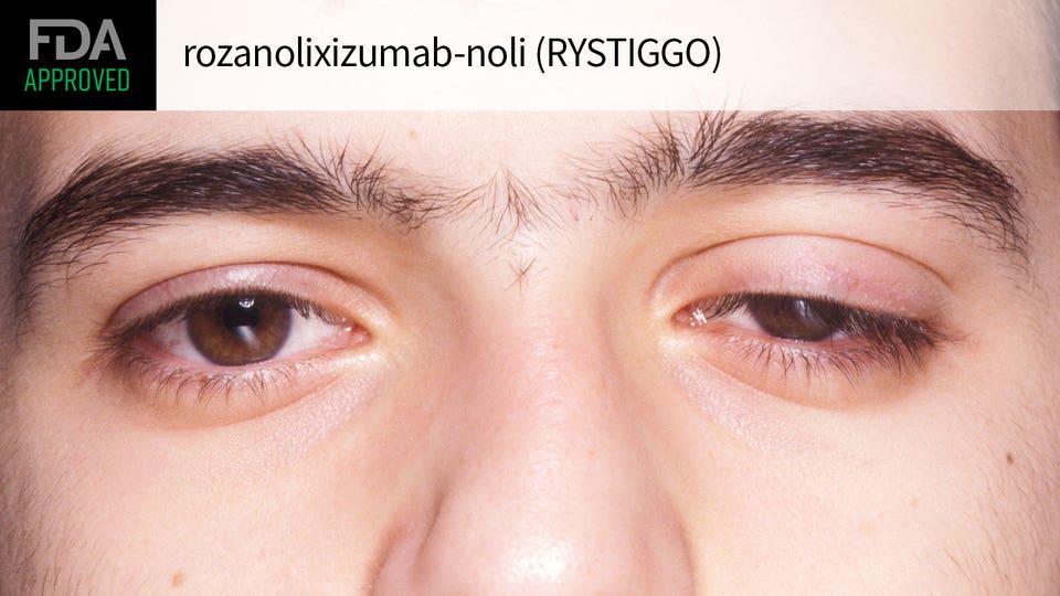 RYSTIGGO(rozanolixizumab-noli)治疗全身型重症肌无力简版中文说明书-价格-适应症-不良反应及注意事项