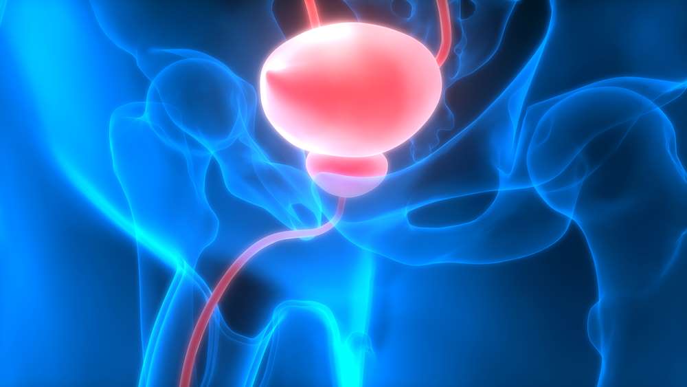 Vibegron对接受前列腺增生治疗的膀胱过度活动症患者有效