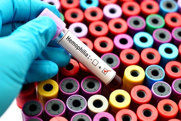 FDA接受Altuviiio更新标签，用于12岁以下患有严重A型血友病的患者