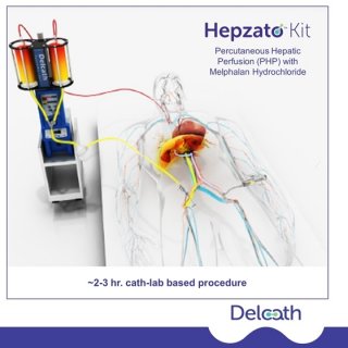 Hepzato Kit(melphalan)治疗葡萄膜黑色素瘤中文说明书-价格-适应症-不良反应及注意事项